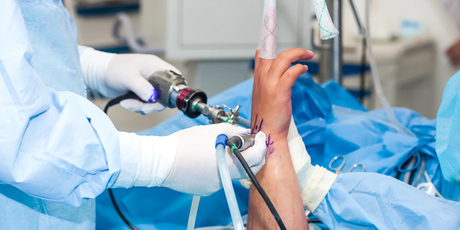 Wrist Arthroscopy with Dr. Rod French