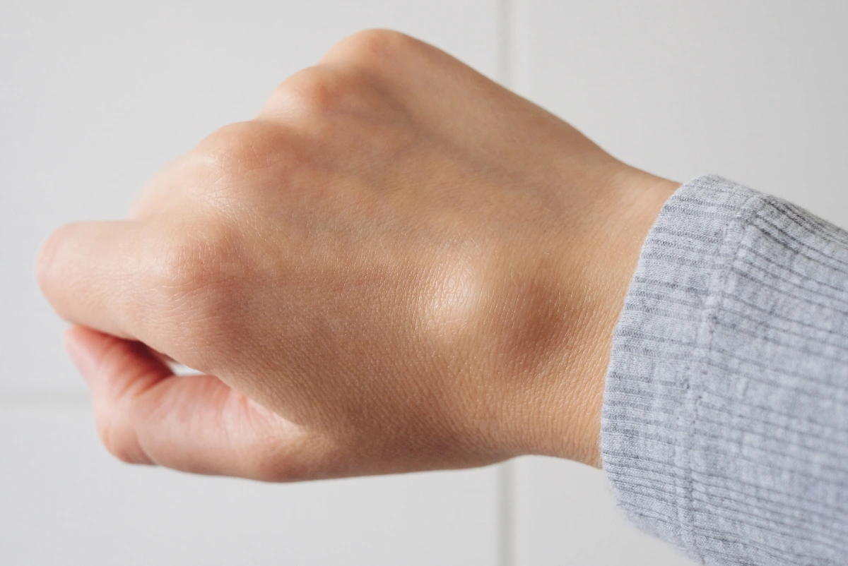 Close-up of a hand showing a hand mass, lump.